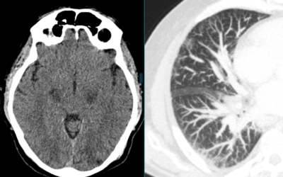 Caso 5: Radiología de urgencias.