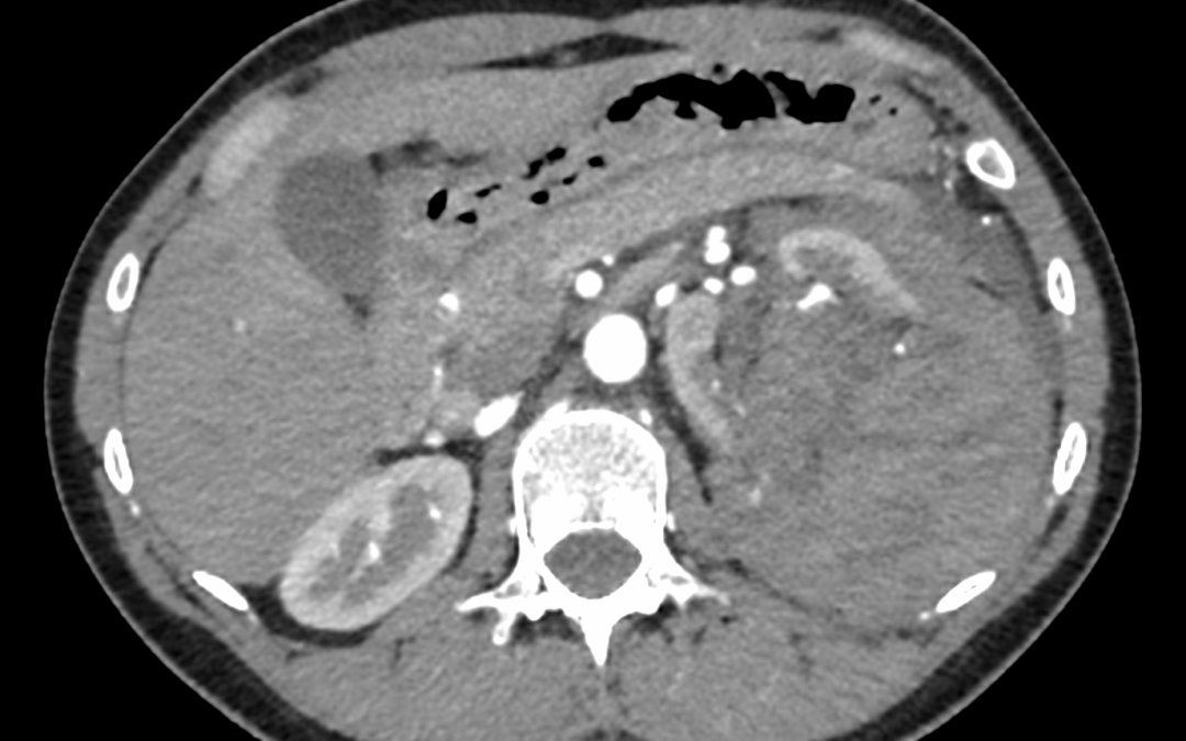 Caso de urgencias (II)