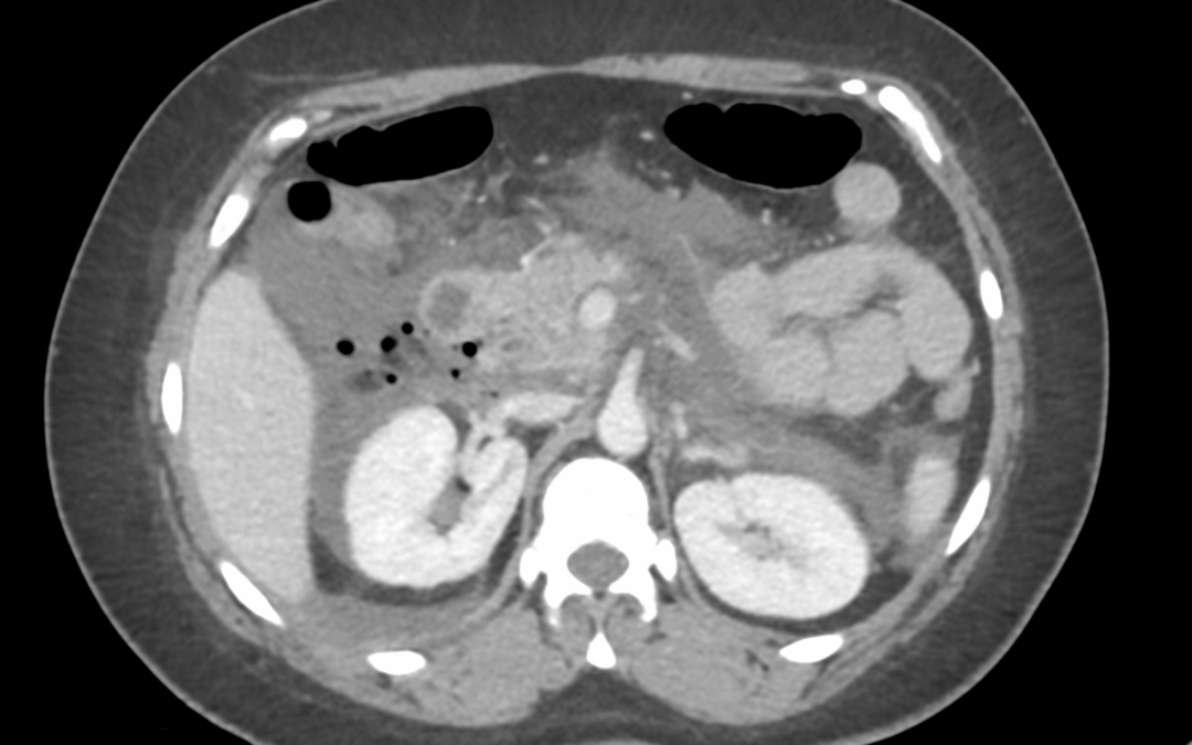 Caso de urgencias (I)